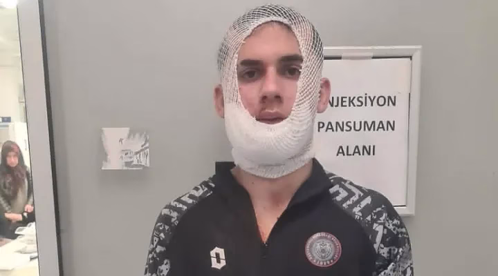 Saha olayları kanlı bitti: Taha Karabacak’a 28 dikiş!